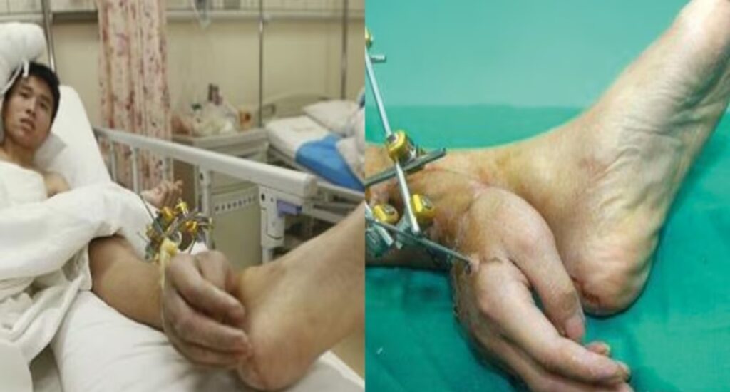 পায়ের সঙ্গে হাত